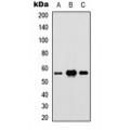 LifeSab™ IRF5 Rabbit pAb (50 µl)