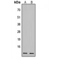 LifeSab™ CDK2AP1 Rabbit pAb (50 µl)