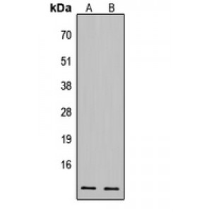 LifeSab™ CDK2AP1 Rabbit pAb (50 µl)