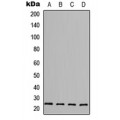 LifeSab™ FGF6 Rabbit pAb (50 µl)