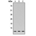 LifeSab™ C35 Rabbit pAb (50 µl)