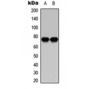LifeSab™ PKC beta Rabbit pAb (50 µl)