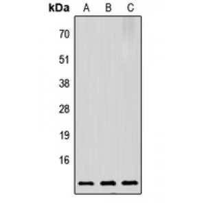 LifeSab™ Prothymosin alpha Rabbit pAb (50 µl)