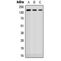 LifeSab™ ROBO2 Rabbit pAb (50 µl)
