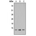 LifeSab™ SH2D1A Rabbit pAb (50 µl)