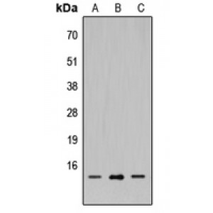 LifeSab™ SH2D1A Rabbit pAb (50 µl)