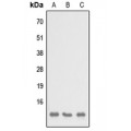LifeSab™ SH3BGRL3 Rabbit pAb (50 µl)