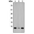 LifeSab™ TCEAL8 Rabbit pAb (50 µl)