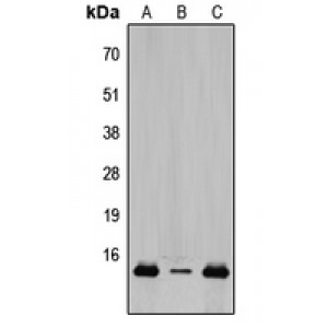 LifeSab™ TCEAL8 Rabbit pAb (50 µl)