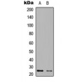LifeSab™ EIF4E3 Rabbit pAb (50 µl)