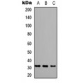 LifeSab™ GRB2 Rabbit pAb (50 µl)