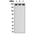 LifeSab™ PDGFR beta (pY751) Rabbit pAb (50 µl)