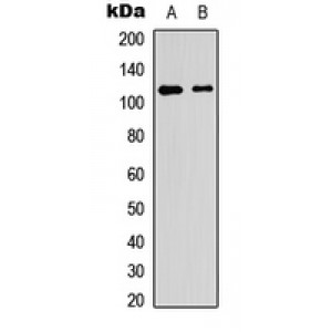 LifeSab™ PTP alpha (pY798) Rabbit pAb (50 µl)