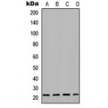 LifeSab™ sTnT Rabbit pAb (50 µl)