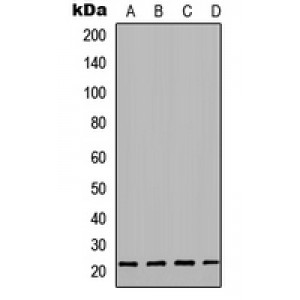 LifeSab™ sTnT Rabbit pAb (50 µl)