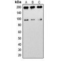 LifeSab™ IGF1 Receptor Rabbit pAb (50 µl)