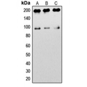 LifeSab™ IGF1 Receptor Rabbit pAb (50 µl)