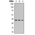 LifeSab™ HEY2 Rabbit pAb (50 µl)