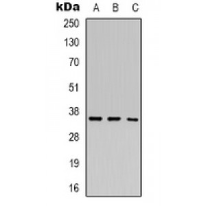 LifeSab™ HEY2 Rabbit pAb (50 µl)