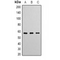 LifeSab™ Angiopoietin-1 Rabbit pAb (50 µl)