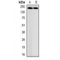 LifeSab™ Myosin-pan (AcK505) Rabbit pAb (50 µl)
