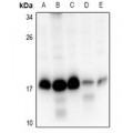 LifeSab™ RPS15 Rabbit pAb (50 µl)