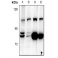 LifeSab™ BCAS3 Rabbit pAb (50 µl)