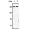 LifeSab™ ROCK2 Rabbit pAb (50 µl)