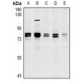 LifeSab™ CNGA1 Rabbit pAb (50 µl)