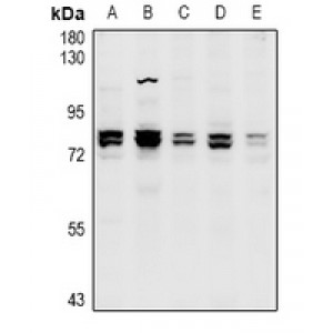LifeSab™ CNGA1 Rabbit pAb (50 µl)