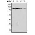 LifeSab™ PKC beta (pT641) Rabbit pAb (50 µl)