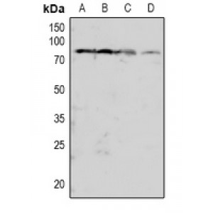 LifeSab™ PKC beta (pT641) Rabbit pAb (50 µl)