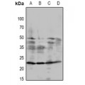 LifeSab™ DSCR1 Rabbit pAb (50 µl)