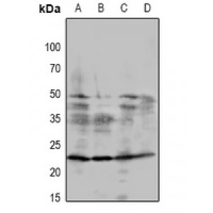 LifeSab™ DSCR1 Rabbit pAb (50 µl)