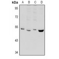 LifeSab™ PPP2R2B Rabbit pAb (50 µl)