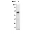 LifeSab™ EPO Receptor Rabbit pAb (50 µl)
