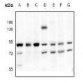 LifeSab™ PKC-pan Rabbit pAb (50 µl)