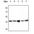 LifeSab™ Actin-pan Rabbit pAb (50 µl)