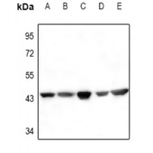 LifeSab™ Actin-pan Rabbit pAb (50 µl)