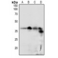 LifeSab™ DSCR1 (pS108) Rabbit pAb (50 µl)