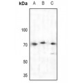 LifeSab™ BTK Rabbit pAb (50 µl)