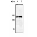 LifeSab™ EGFR Rabbit pAb (50 µl)