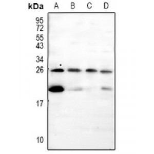 LifeSab™ Pleiotrophin Rabbit pAb (50 µl)