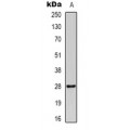 LifeSab™ HMGB1 (AcK12) Rabbit pAb (50 µl)
