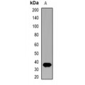 LifeSab™ Beta Amyloid Rabbit pAb (50 µl)