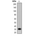 LifeSab™ Factor IX Rabbit pAb (50 µl)