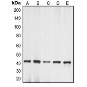 LifeSab™ Gamma-actin-1 Rabbit pAb (50 µl)
