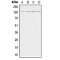 LifeSab™ Adenylate Cyclase 5/6 Rabbit pAb (50 µl)