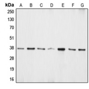 LifeSab™ APE1 Rabbit pAb (50 µl)