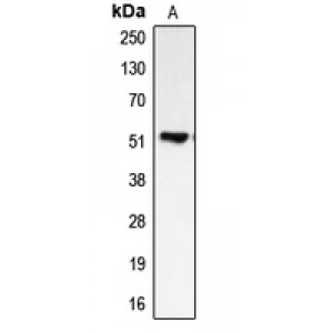 LifeSab™ BMP5 Rabbit pAb (50 µl)